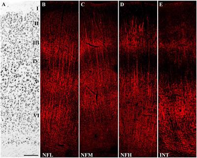 Expression of Neurofilament Subunits at Neocortical Glutamatergic and GABAergic Synapses